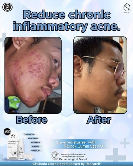 thymoQueen SERUM - Image 13